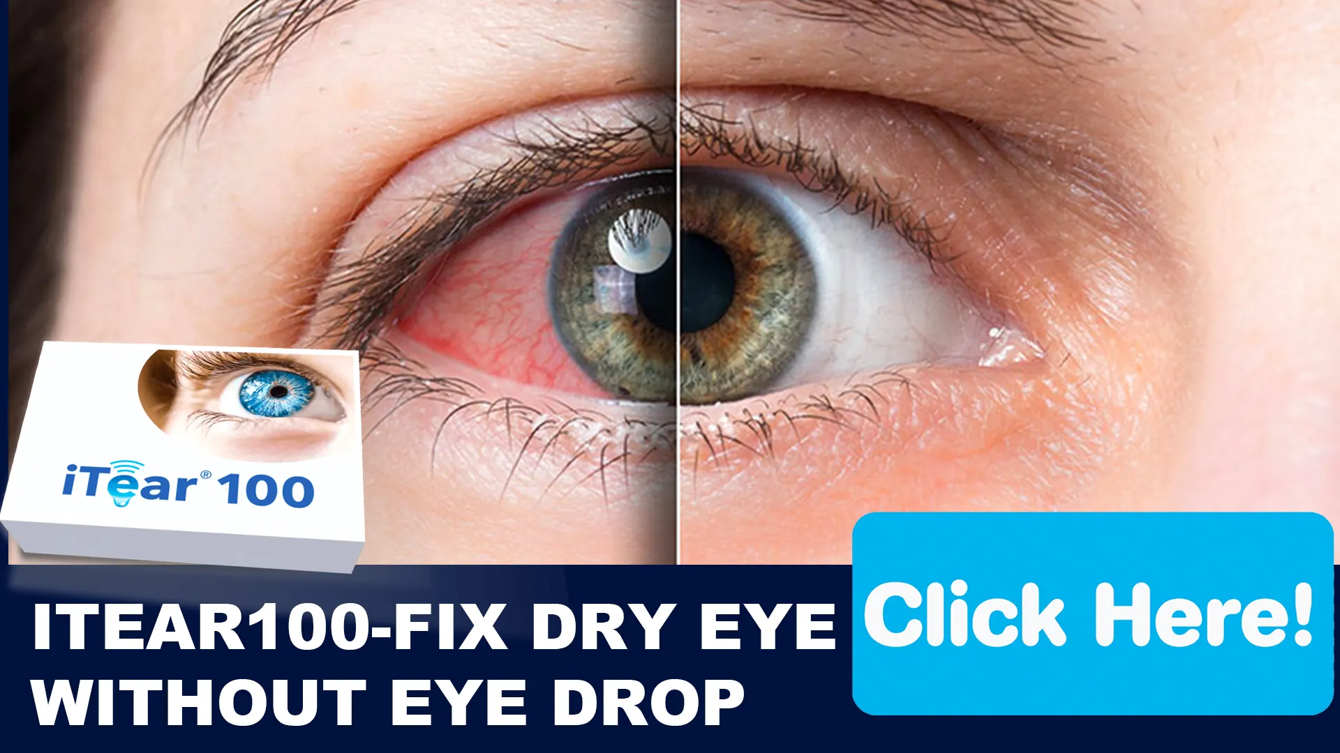 Understanding Dry Eye Syndrome and Its Impact