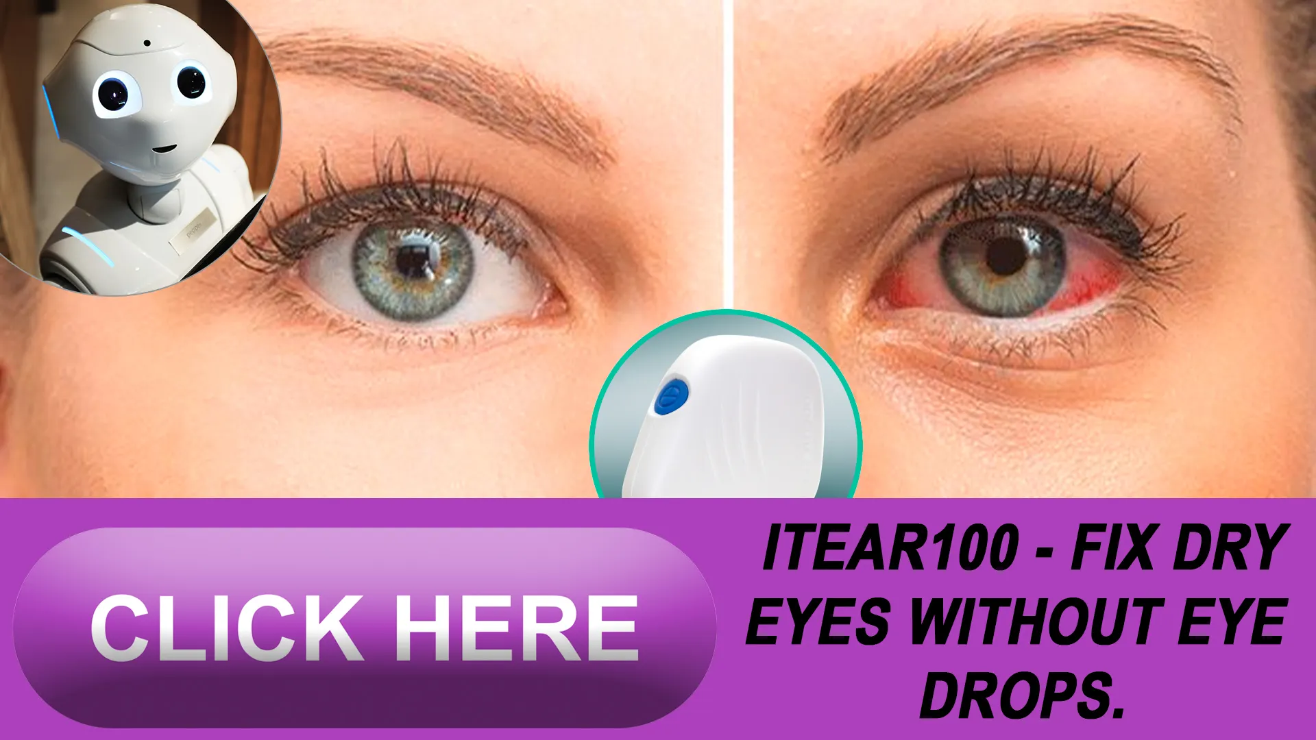  Introducing the iTEAR100: Your Personal Eye Oasis 