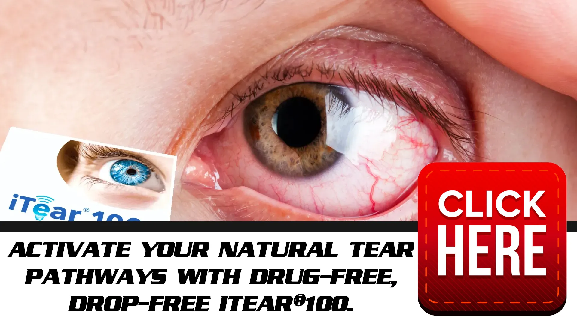 Experience Immediate Relief with iTear100